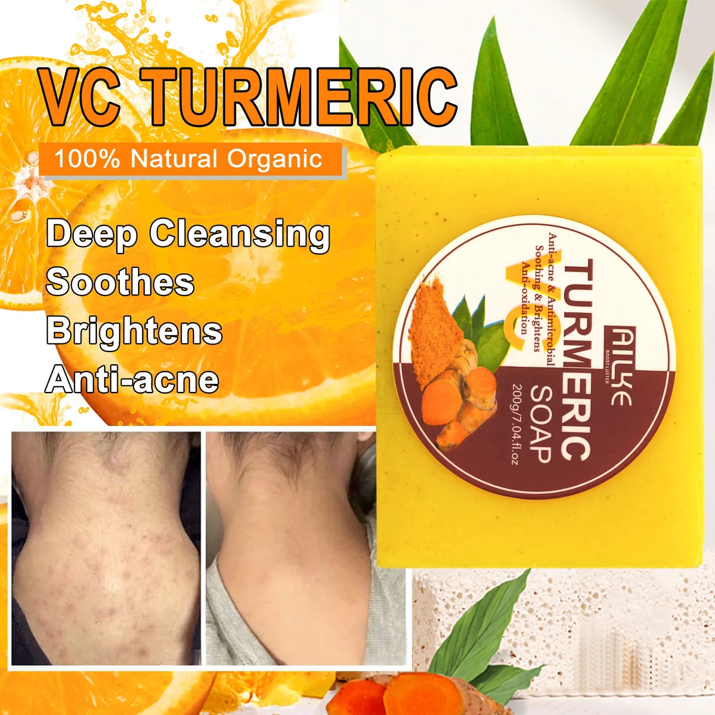 AILKE Turmeric Set for Whiten, Even Skin Tone, Hydrate